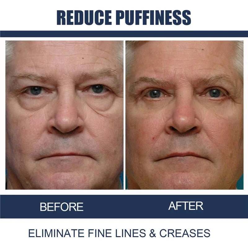 Retinol Eye Cream for Men, 15g