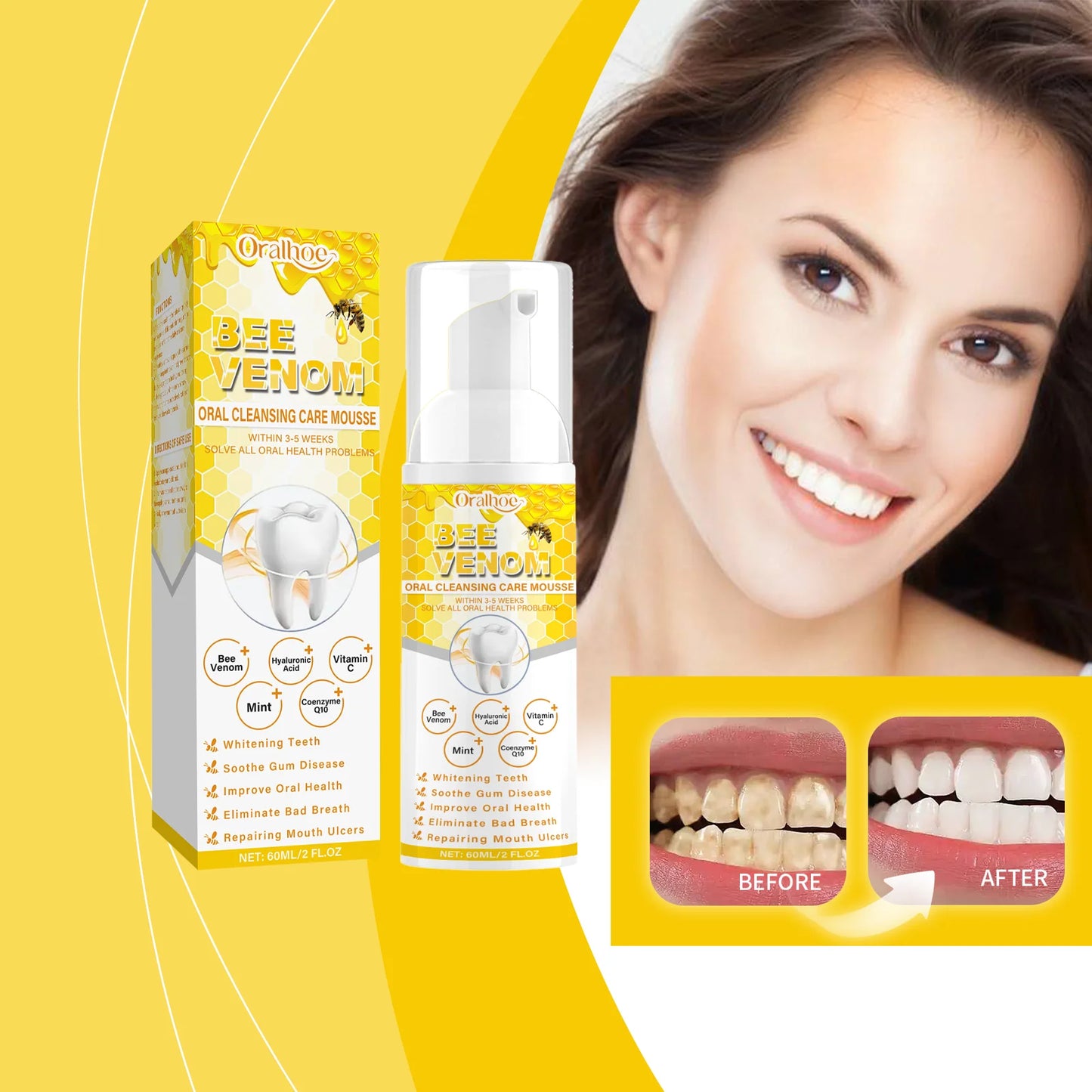 Bee Venom Toothpaste Mousse — Whitening Foam, Fresh Breath, Gentle Care